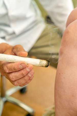 ternative medicine therapist doing moxa treatment on her clientの写真素材