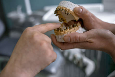 Dentistry and prosthetics. The path to beautiful teeth and good health. Dentures in human hands.の写真素材