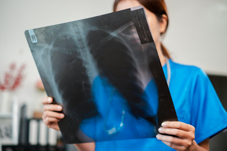 A healthcare worker in blue scrubs holds and examines a chest X-ray in a clinical environment.の写真素材