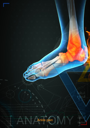 3d illustration of ankle pain by x- ray on backgroundの写真素材
