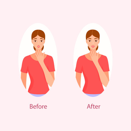 acne treatment before after cartoon vector illustrationのイラスト素材