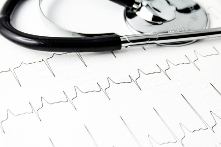 Cardiogram with stethoscopeの写真素材