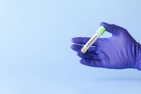 test tube in hand of lab technician with sample of coronavirus covid-19, deadly global pandemic conceptの写真素材
