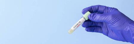 test tube in hand of lab technician with sample of coronavirus covid-19, deadly global pandemic...