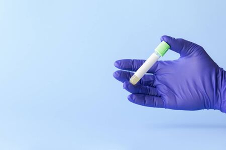 test tube in hand of lab technician with sample of coronavirus covid-19, deadly global pandemic conceptの写真素材