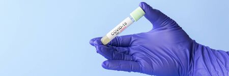 test tube in hand of lab technician with sample of coronavirus covid-19, deadly global pandemic conceptの写真素材