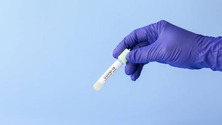 test tube in hand of lab technician with sample of coronavirus covid-19, deadly global pandemic conceptの写真素材