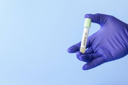test tube in hand of lab technician with sample of coronavirus covid-19, deadly global pandemic conceptの写真素材