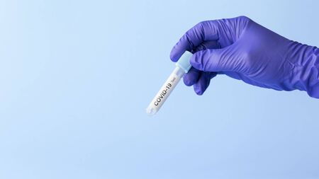 test tube in hand of lab technician with sample of coronavirus covid-19, deadly global pandemic conceptの写真素材
