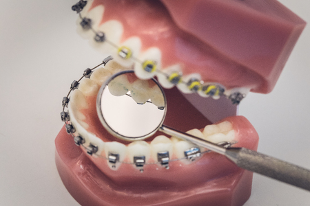 Detailed close up of dental instrument working on a denture or teeth on a table, dentistryの写真素材