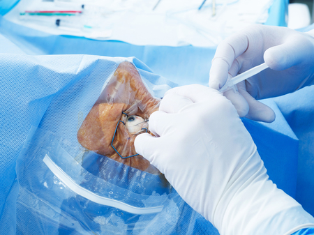 Eye surgery