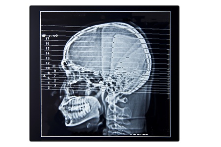 brain scan film