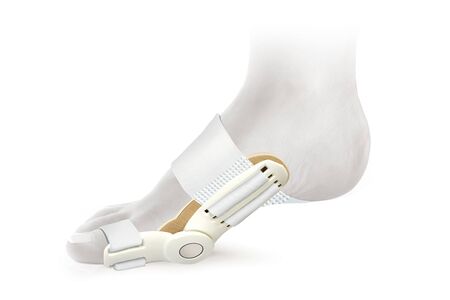 Hallux Valgus Orthopedic Medical Thumb Brace isolated on white background. Orthoses for toes.の写真素材