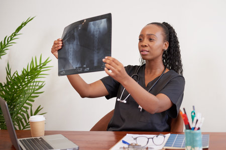 A Black female doctor examines patient x-ray of abdomen to diagnose diseaseの写真素材