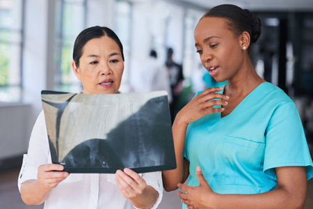 Diverse Medical Team Analyzing X-ray in a Hospital Settingの写真素材