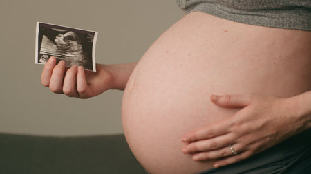 Close-Up of Pregnant Woman Holding Ultrasound Image and Touching Belly in Anticipation of New Life...