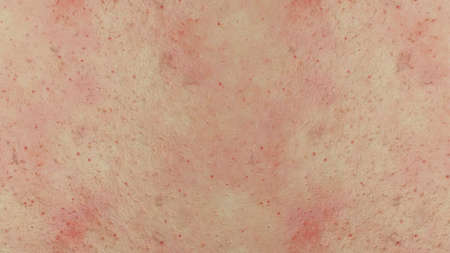 Textured skin background close upの写真素材