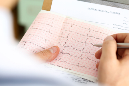 Male medicine doctor hands holding cardiogram chart on clipboard pad closeup. Cardio therapeutist assistance, physician make cardiac physical, heart rate measure document, arrhythmia conceptの写真素材