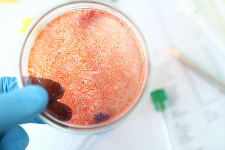 Close-up of results of chemical research. Component analysis. Scientist holding search colorful...