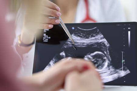 Doctor shows pregnant woman an ultrasound scan of fetus. Medical examination during pregnancy...