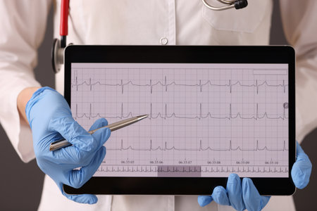 Doctor in rubber gloves holding digital tablet with cardiogram closeup. ECG diagnosis of rhythm disturbances conceptの写真素材