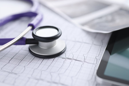There is cardiogram tablet and stethoscope on table. Examination of the cardiovascular system conceptの写真素材