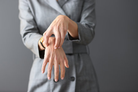 Woman in gray dress scratching her hands close-up. Emergence of allergic diseases concept