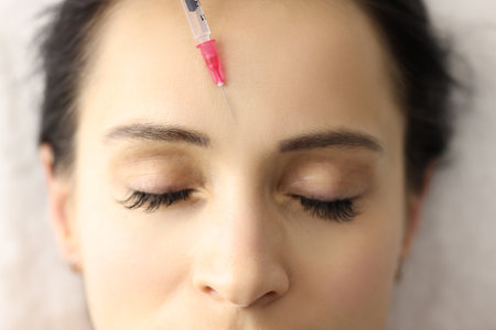 Cosmetic injection is given to forehead of young woman closeup. Correction of facial wrinkles conceptの写真素材