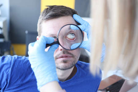 Doctor examining patients eye with magnifying glass closeup. Foreign body of the eye concept