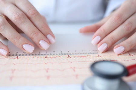 Doctor cardiologist examining electrocardiogram with ruler closeup. Functional diagnostics conceptの写真素材