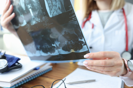 Doctor examines an X-ray of patient in medical office. Research of tumors in the human body conceptの写真素材