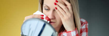 Woman looking in mirror and wiping blood from nose with tissue