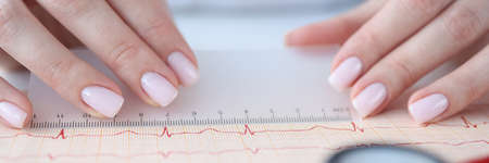 Doctor cardiologist examining electrocardiogram with ruler closeupの写真素材