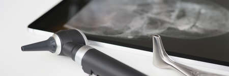 An otoscope with an X-ray is on table