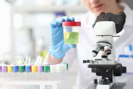 Laboratory scientist holds container with urine test closeopの写真素材