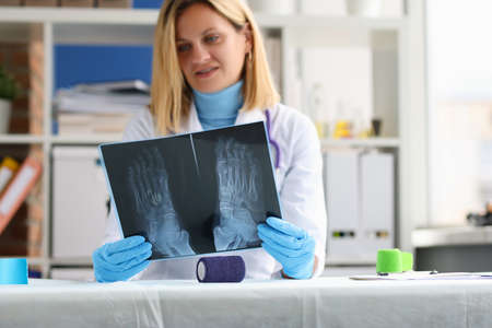 Female doctor examines an x-ray of patient legの写真素材