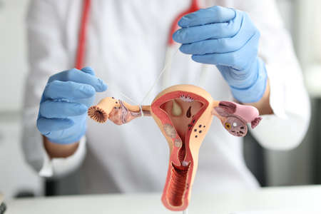 Gynecologist shows how to ligate the fallopian tubes on training model of female reproductive systemの写真素材