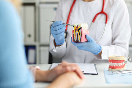 Dentist shows on dental model how caries destroys tooth enamelの写真素材