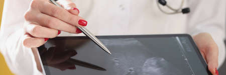 Gynecologist shows ultrasound of baby fetus on tabletの写真素材