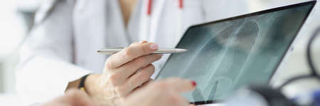 Doctor shows patient an x-ray of lungs on tablet closeup