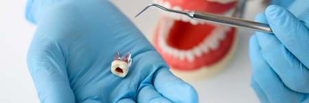 Dentist doctor hand in glove shows tooth closeupの写真素材