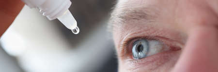 Young caucasian man shot in head with eye dropsの写真素材
