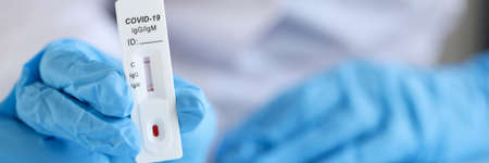 Doctor wearing disposable gloves holds positive PCR test for coronavirus infection