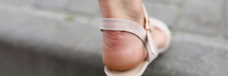 Womans leg in high-heeled sandals close upの写真素材