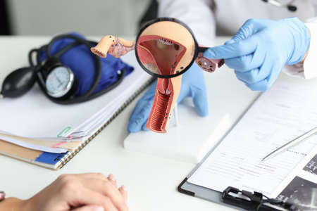 Doctor show patient on reproductive system model, explain problem to client, magnifying glassの写真素材
