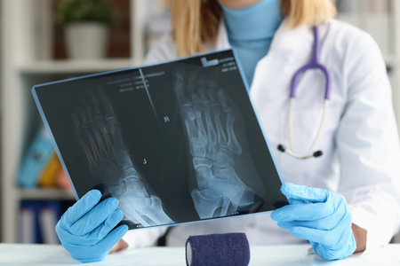 Doctor traumatologist examines x-ray of feet closeupの写真素材