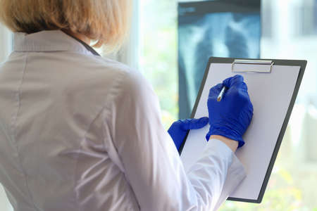 Hand of doctor writing notes on clipboard in medical and looking through x-ray film