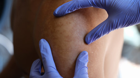 Dermatologist examining patients skin in clinic.