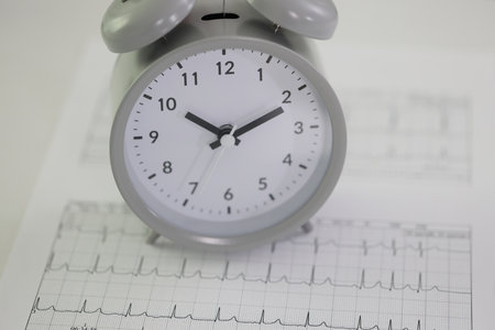 Alarm clock stands on cardiogram papers on table in hospitalの写真素材