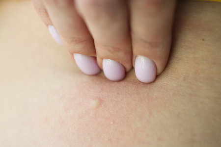 Female hand touches skin with rash examining eczema